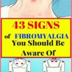 43 Signs of Fibromyalgia You Should Be Aware Of