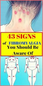 43 Signs of Fibromyalgia You Should Be Aware Of